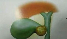 胆结石吃吊瓜,吊瓜食疗助您轻松化解结石困扰